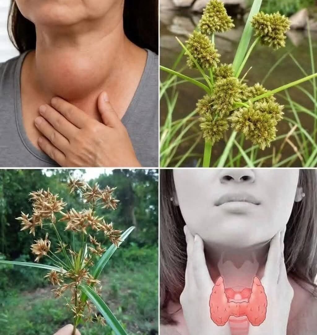 6 Simple Steps to Support Your Thyroid Naturally 828018517_122278532150253255_9216676772969880693_n