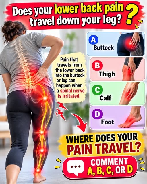 Does Your Lower Back Pain Travel Down Your Leg? 828831764_3454470871610265_3454575416696985956_n