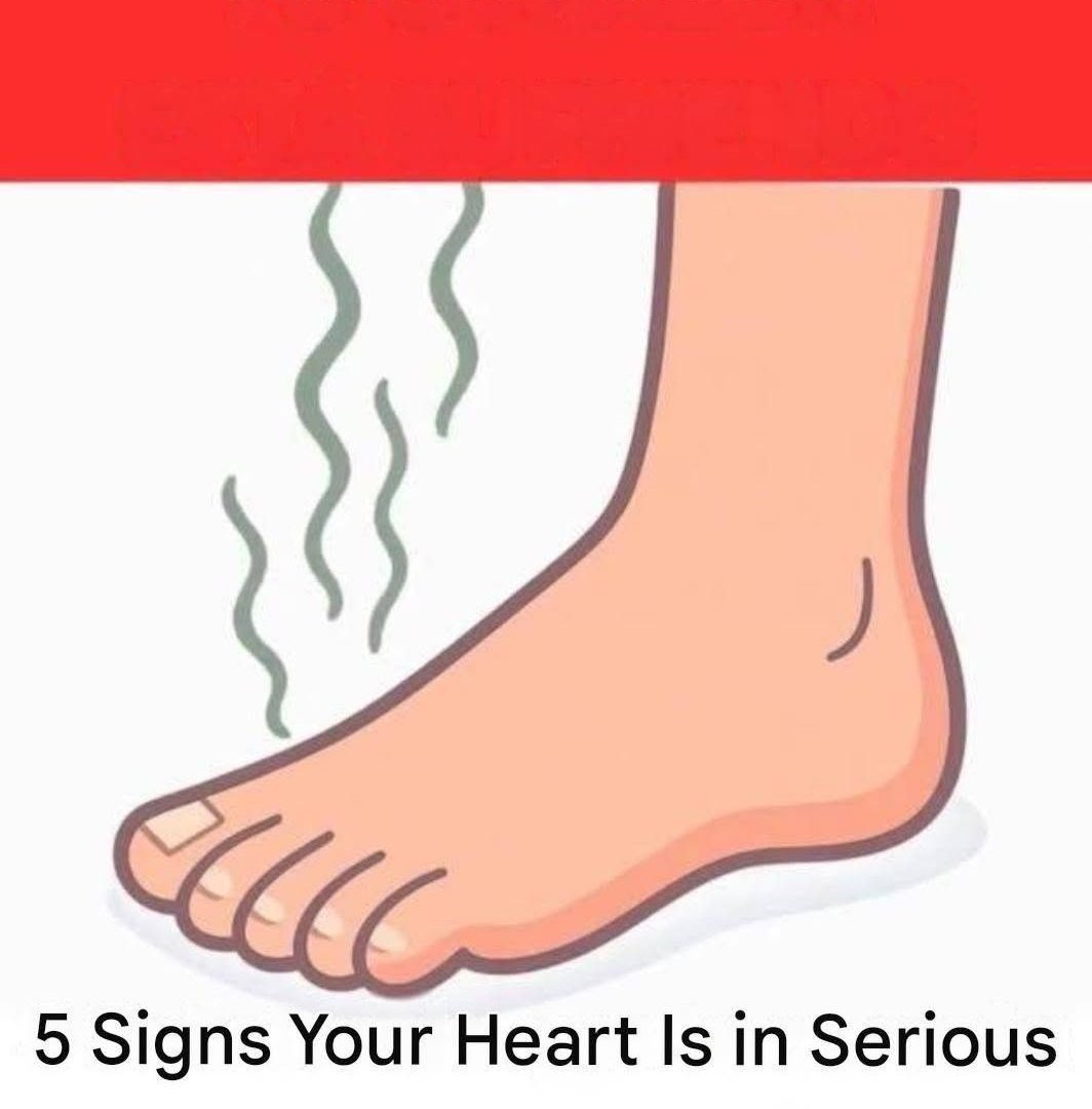 5 Warning Signs Your Heart May Be in Danger 830199776_122184384230952110_7856135130095727456_n