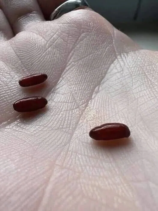 What Is This Small Object Found on My Bed? image