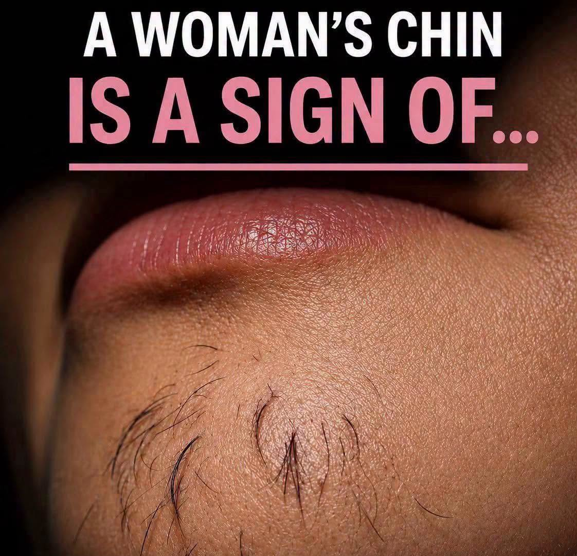 What Does Chin Hair in Women Mean? image