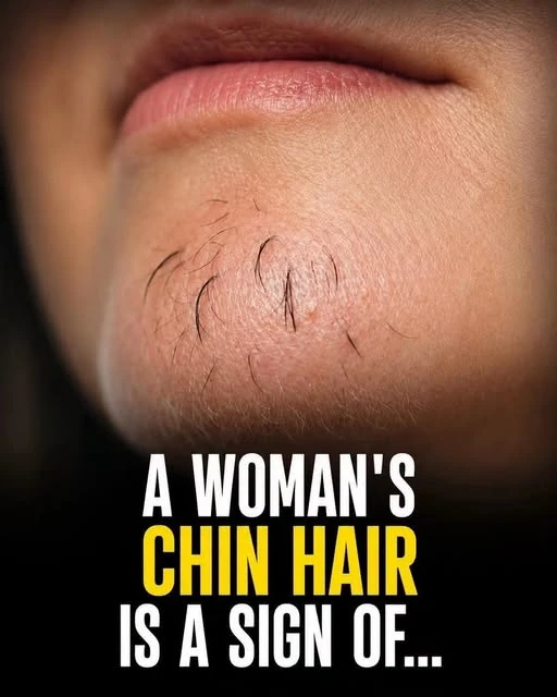 A Woman's Chin Hair Is a Sign Of... What You Need to Know wordpress_ready_chin_hair